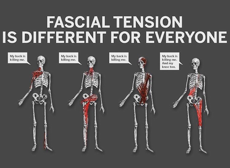 Understanding Fascial Restrictions Fascia Back Pain